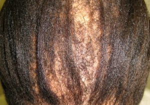 The Top 7 Reasons You’re Losing Hair (and Why It Matters for Your Growth Journey)